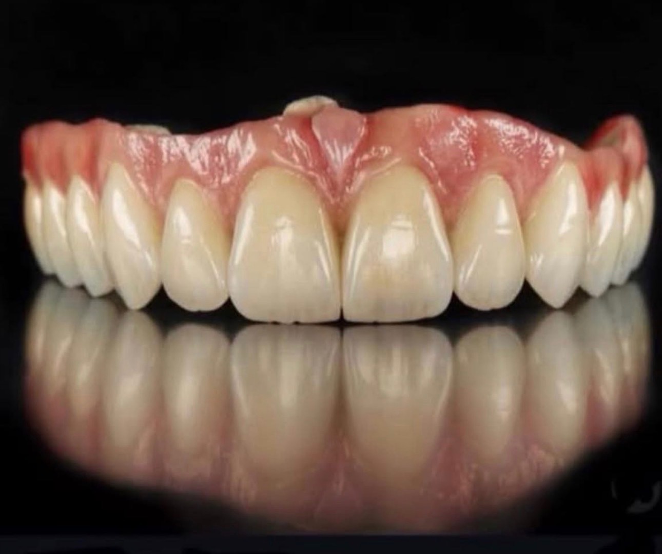 Esthetic full-arch dental restoration